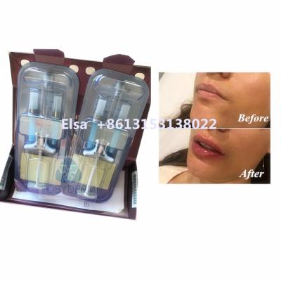 Chine Injection faciale de remplisseur d'acide hyaluronique de Juvederm Ultra3 Ultra4 Voluma à vendre