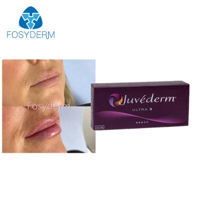 Китай Заполнитель 2x1.0ml повышения губы Juvederm Ultra3 Hyaluronic кисловочный дермальный продается