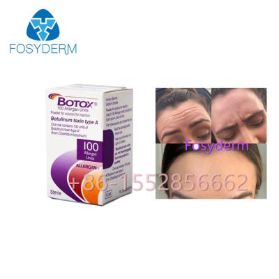 China Allergan Botox 100 Units Botulinum Toxin Anti Wrinkles Type A Injection for sale