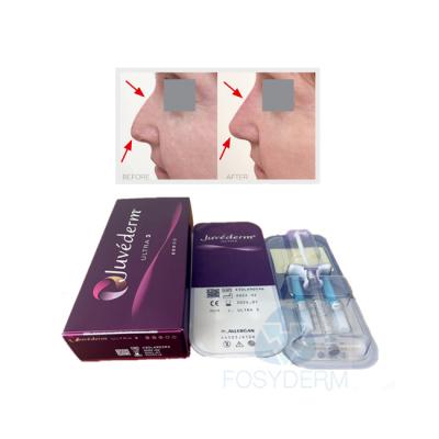 Chine Face Lip Crosslinked Dermal Filler Juvederm Ultra3 Hyaluronic Acid Gel à vendre