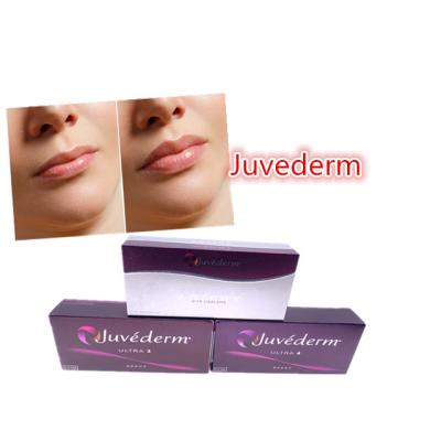 Chine Cross Linked Dermal Filler Juvederm Ultra3 Ultra4 For Lips 24mg/Ml à vendre