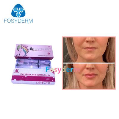 China Van de de Vullers Hyaluronic Zure Lip van de Fosyderm2ml de Huidlip van de de Verhogingsinjectie Lijn van Derm Te koop