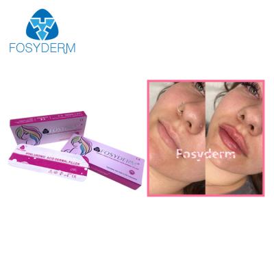 Κίνα Durability Dermal Lip Fillers High Safety 2ml With Good Shape Retention προς πώληση