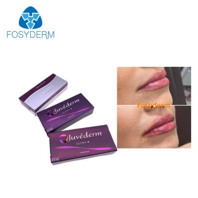 Κίνα Anti Wrinkles Juvederm Dermal Lip Fillers 2*1ml Hyaluronic Acid Injection προς πώληση