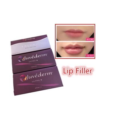 China 2 ml de Ácido Hialurónico Combinado com Enchimento Dermológico Juvederm Injecções de Enchimento de Lábios à venda