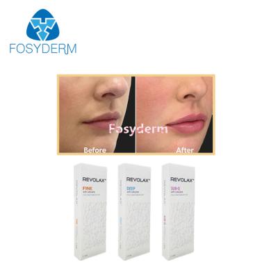 Κίνα 1.1 ml Dermal Lip Fillers Revolax Fine Deep Sub- Q για την Ενέσιμη Υαλουρονικό οξύ κατά των ρυτίδων προς πώληση