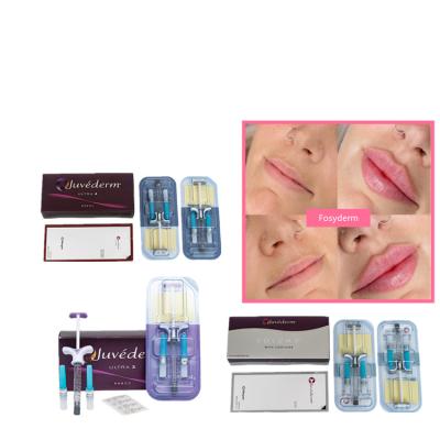 China Juvederm Dermal Lip Fillers 2*1ml Hyaluronic Acid Cross Linked Injection en venta