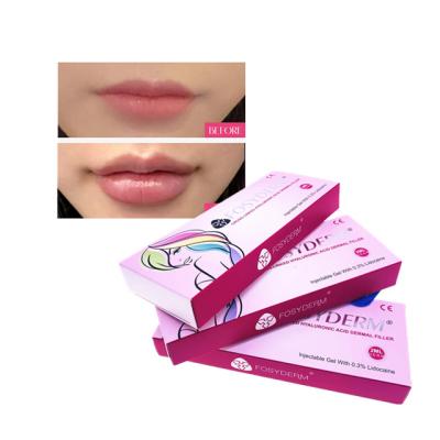 Cina HA Injectable Dermal Filler Fullness Lip Filler Injections Anti Aging in vendita