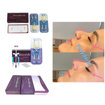 Chine Juvederm 2*1 ml Remplisseur cutané croisé anti-rides Remplisseur facial à vendre