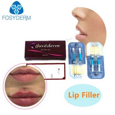 China 2 ml de enchimento cutâneo com ácido hialurónico JUVEDERM Gel injetável para enchimento de rugas à venda