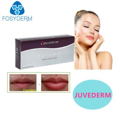 China Juvederm Hyaluronsäure Hautfüllmittel Sexy Lippen 24mg Für Gesichtsfüllmittel zu verkaufen