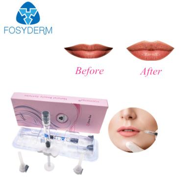 China 2ml Dermal Cross Linked Hyaluronic Pen Fillers for sale