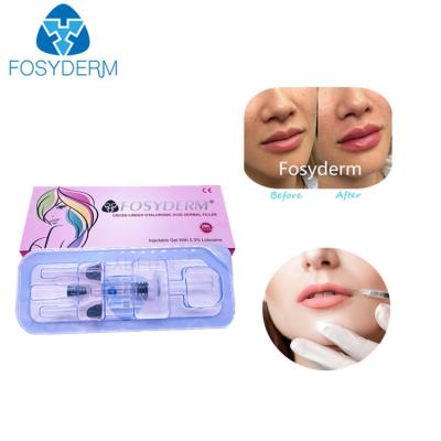 China 2 Ml Acid Hyaluronic Cross Linked Dermal Filler Lip Filler Injections for sale