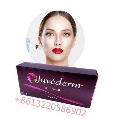 China Kreuz verbundenes Hauteinspritzungen lippenfüller Juvederm Ultra3 saures Hyaluronic zu verkaufen