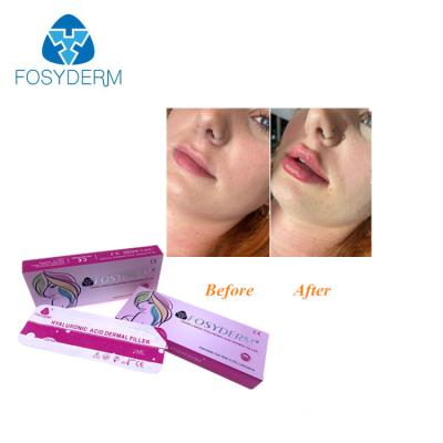 China Hyaluronic Acid Dermal Injectable Filler For Nose Face for sale