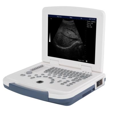 China Yes Cheapest Rechargeable LTUB45 Laptop Basic BW Ultrasound Scanner for sale