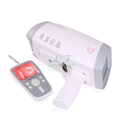 China Other electronic handheld colposcopy LTEC01 for sale