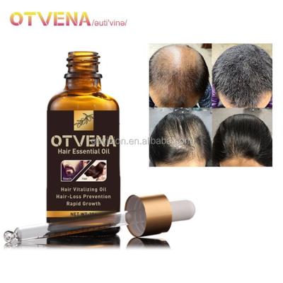 China Anti-Dandruff Hair Beard Care OTVENA Dropper Hair Growth Oil Private Label for sale