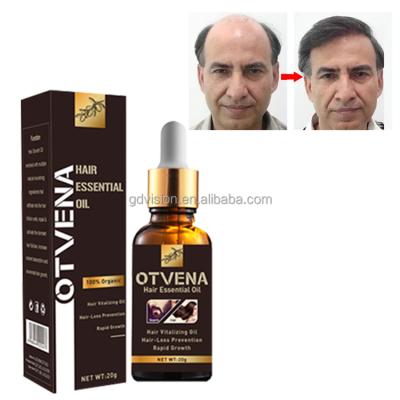 China Wholesale Price OTVENA 100% Natural Beard Anti Hair Loss Hair Care Nourish Hair Growth Oil Kenya for sale