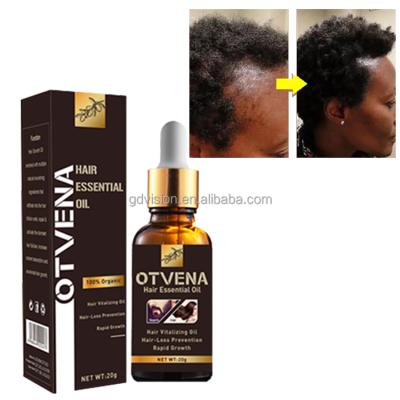 China Men or Women Private Label Black Hair Edage Control Hair Growth Oil Afro for sale