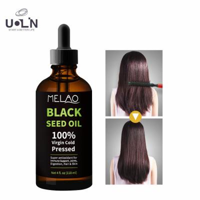 China 100% Seed Essential Oil Softgels Skin Nourishing Pure Natural Black Organic Cold Pressed Hair Body Massage Oil For Hair for sale