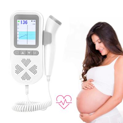 China Plastic for Homecare Portable Ultrasound Zero Radiation Machine with Waveform Fetal Doppler Monitor for sale