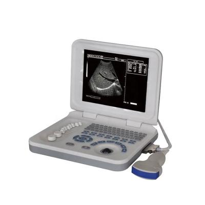 China Gynecological Examination Device Portable Abdomen Pregnancy Ultrasound Scanner for sale