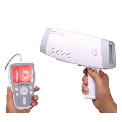 China Mini Type Portable Gynecology Equipment Digital Colposcope Machine MK-PL9800 for sale