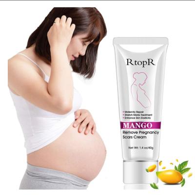 China 40g Moisturizer Mango Stretch Marks Remover Cream Eliminate Pregnancy Marks Anti Maternity Repair Winkle Skin Firming Treatment for sale