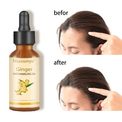 China Wholesale Custom Soft Ginger Mild Ginger Oil Hair Loss Prevention Anti Loss Hair Growth Treatment for sale