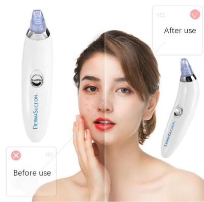 China Blackhead Multi Head Pore Remover Blackhead Remover Nose Blackhead Extractor Deep Facial Cleansing Remover With 4 Replaceable Heads for sale