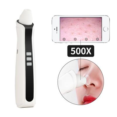 China Acne Treatment Blackhead Remover Vacuum Blackhead Remover Vacuum Blackhead Exporter for sale