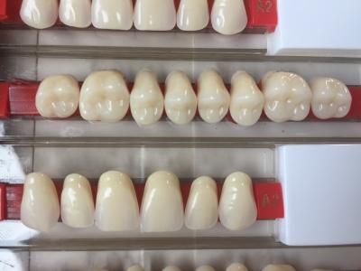 China High Strength Artificial Dental Acrylic Resin Teeth With High Biocompatibility for sale