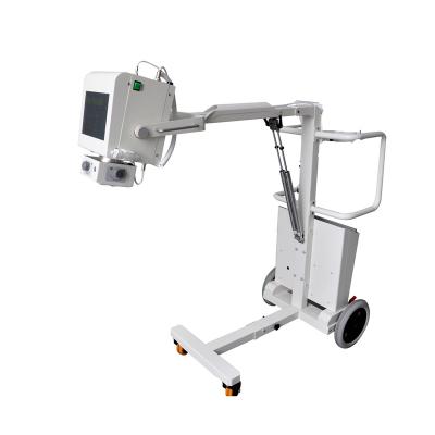 China Metal Medical Portable X-ray Machine 5.6KW 125KV 100mA X Ray Scanner High Frequency Analog With Battery for sale