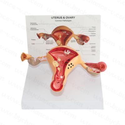 China Female Reproductive Organ Human Anatomical Reproductive System Model Learning Resources Uterus Anatomical Model for sale