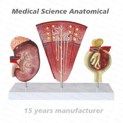 China Urinary Tract Model Nephron Kits Learning Resources Science Glomerulus Model Kidney Medical Educational Human Model for sale