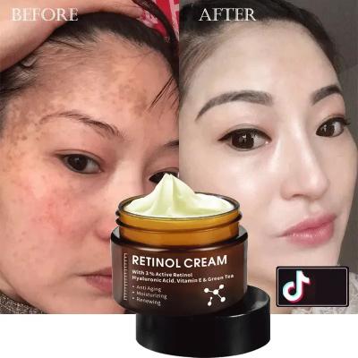 China Strong Whitening Dark Spot Wrinkle Freckle Anti Aging Cream High Quality Anti Aging Removal Whitening Collagen Retinol Vitamin C Face Cream for sale