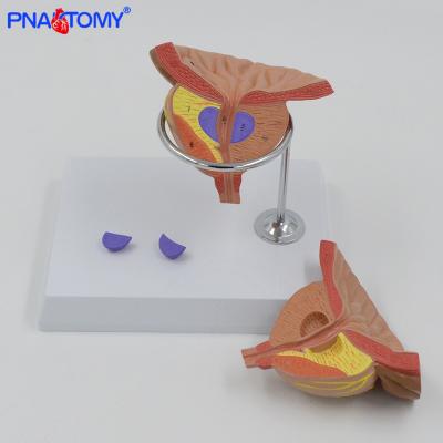 China Anatomy Anatomy Human Anatomical Medical Science Bladder Urinary System Model Prostate Demonstration Educational Tool PNT-0569-3 for sale