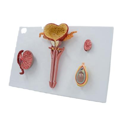 China PVC Medical School Teaching Advanced Anatomical Demonstration Male Reproductive System PNT-0573 Model for sale