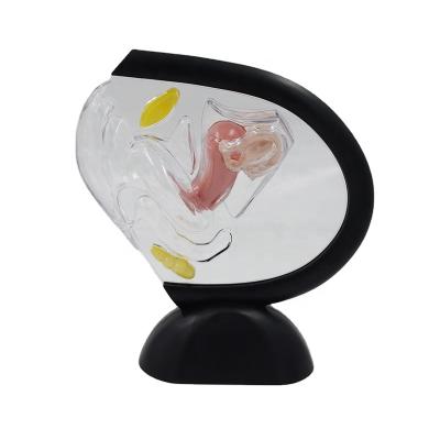 China Medical Science Human Anatomical Educational Models Uterus Transparent Female Model PNT-1583 for sale