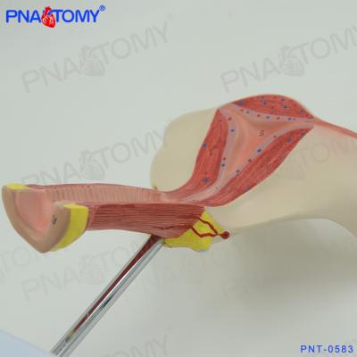 China PNT-0583 PVC Genital Organ Model Medical Science Anatomical Model Picture 18.5*15*16cm Female Internal Advanced PVC NC PNATOMY; JIA for sale