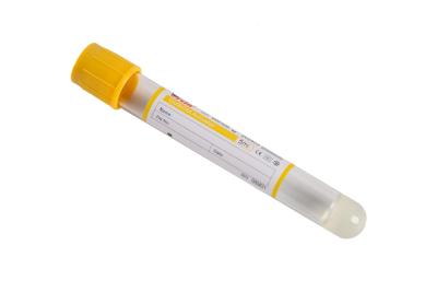 China Convenient and Sterile Vacuum Blood Test Tube for Easy Blood Collection for sale