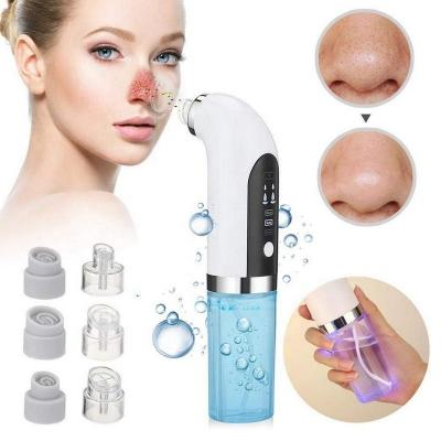 China Acne Treatment Skin Care Tool Blackhead Vacuum Acne Pore Cleaner Remover Waterproof Blackhead Remover Vacuum for sale