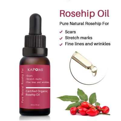 China Pure Natural Skin Revitalizer Organic Rosehip Oil Rosehip Extract Hydrosol Rosehip Essence For Scars Stretch Marks Anti Aging Lift Brighten Skin for sale