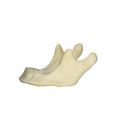 China Detailed Anatomy Structures Lower Jaw Implant Practice Model Dental Model with Silicone Gums for Student Practice Artificial Bone for sale