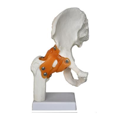 China Patients Care Demonstration Human Anatomical Skeletal Model Of The Hip Joint for sale