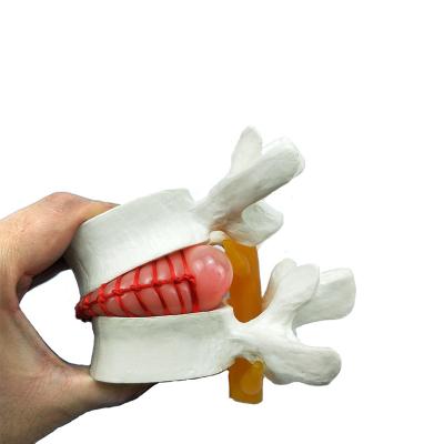 China Lumbar stage operation professional surgical human skeletal model, teaching lumbar model, simulation spine bone model for sale