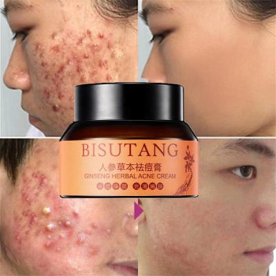 China Moisturizer Ginseng Spots Repair Anti Acne Treatment Acne Removal Cream Moisturizer Acne Moisturizer Face Skin Care Herbal Face Cream Cream for sale