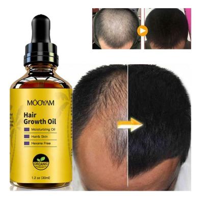 China Effective Salon Hair Care Hair Care Hair Growth Oil 30 Days Hair Restoration Hair Loss Treatment Products For Women Men for sale