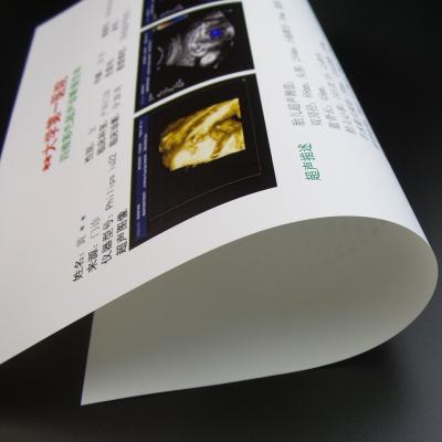 China X Ray CT CR DR White Inkjet Medical Film For X Ray CT CR DR Inkjet Medical Dry Film for sale